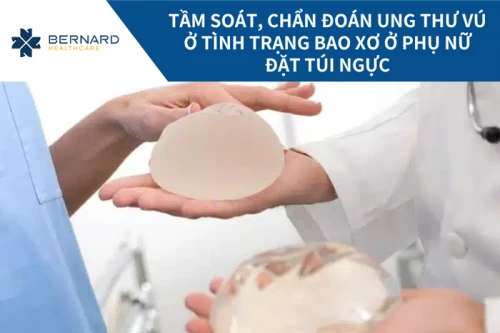Tầm soát & chẩn đoán ung thư vú (bao xơ túi ngực)